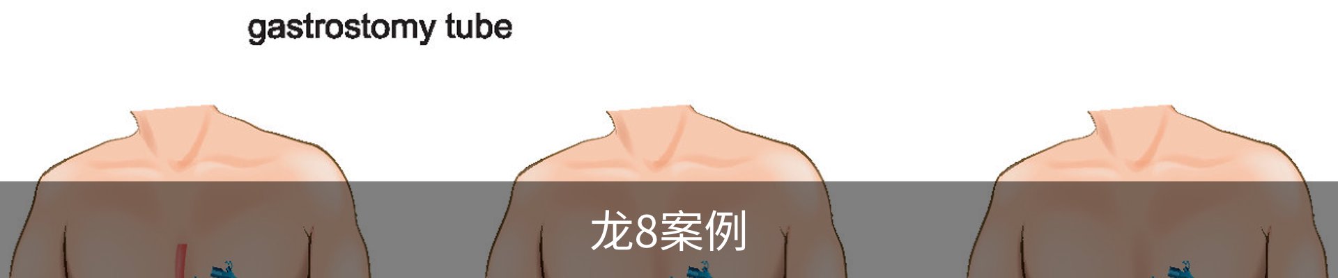 龙8案例